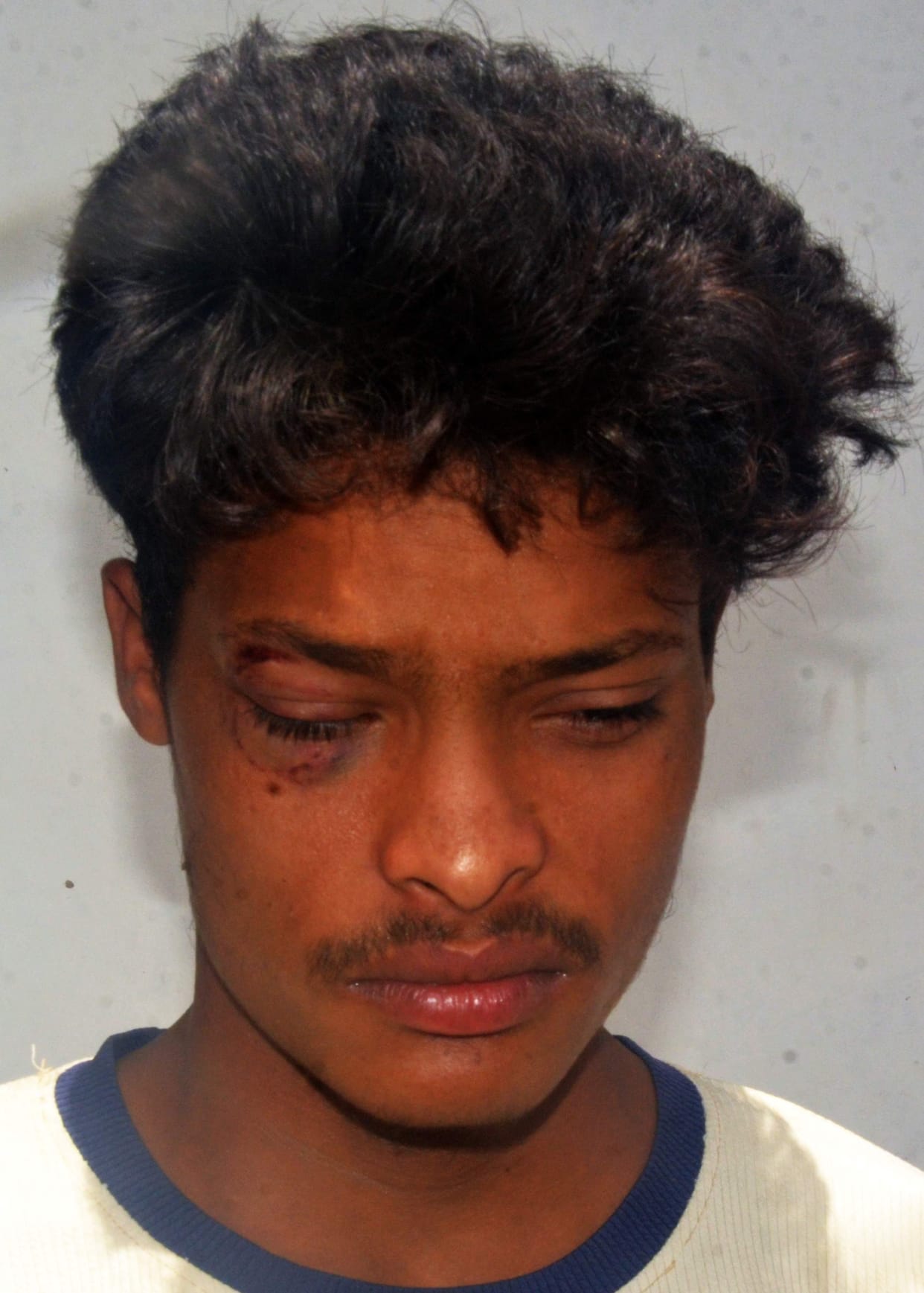 Pack of Dogs Kills Innocent Child; Father Faints Upon Seeing 15 Wounds
