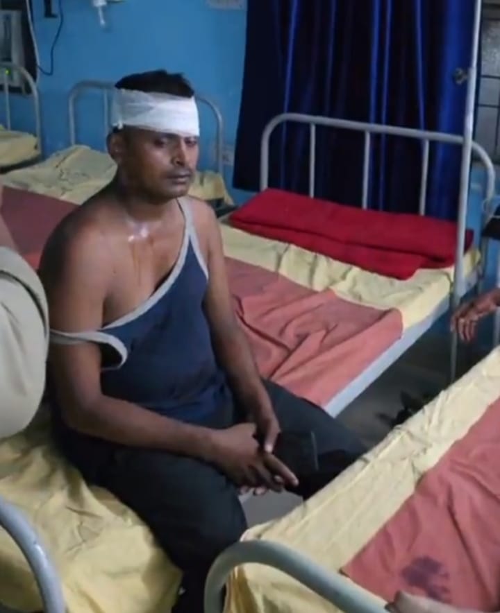 अकबराबाद गुहौली गांव में हुई मारपीट के बाद घायल व्यक्ति। संवाद