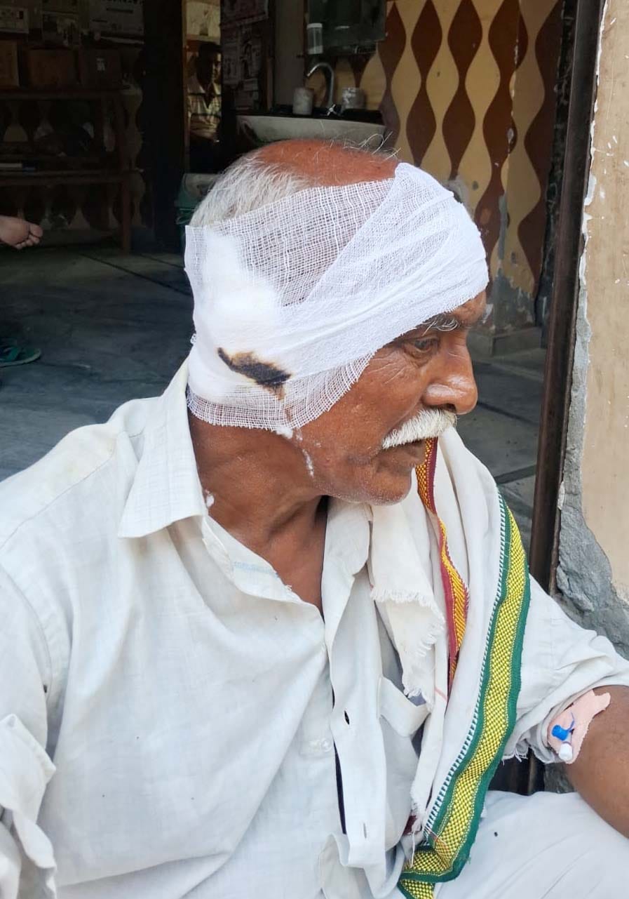 बंदरों को काटने से घायल हुए प्रताप सिंह। संवाद
