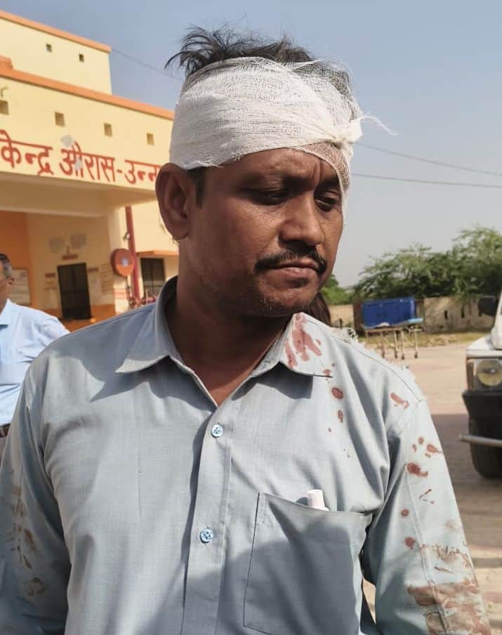 unnao news