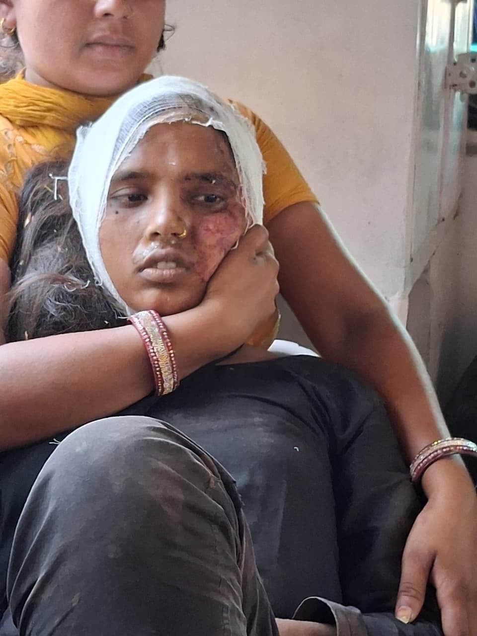 हादसे में घायल शिवकली। संवाद