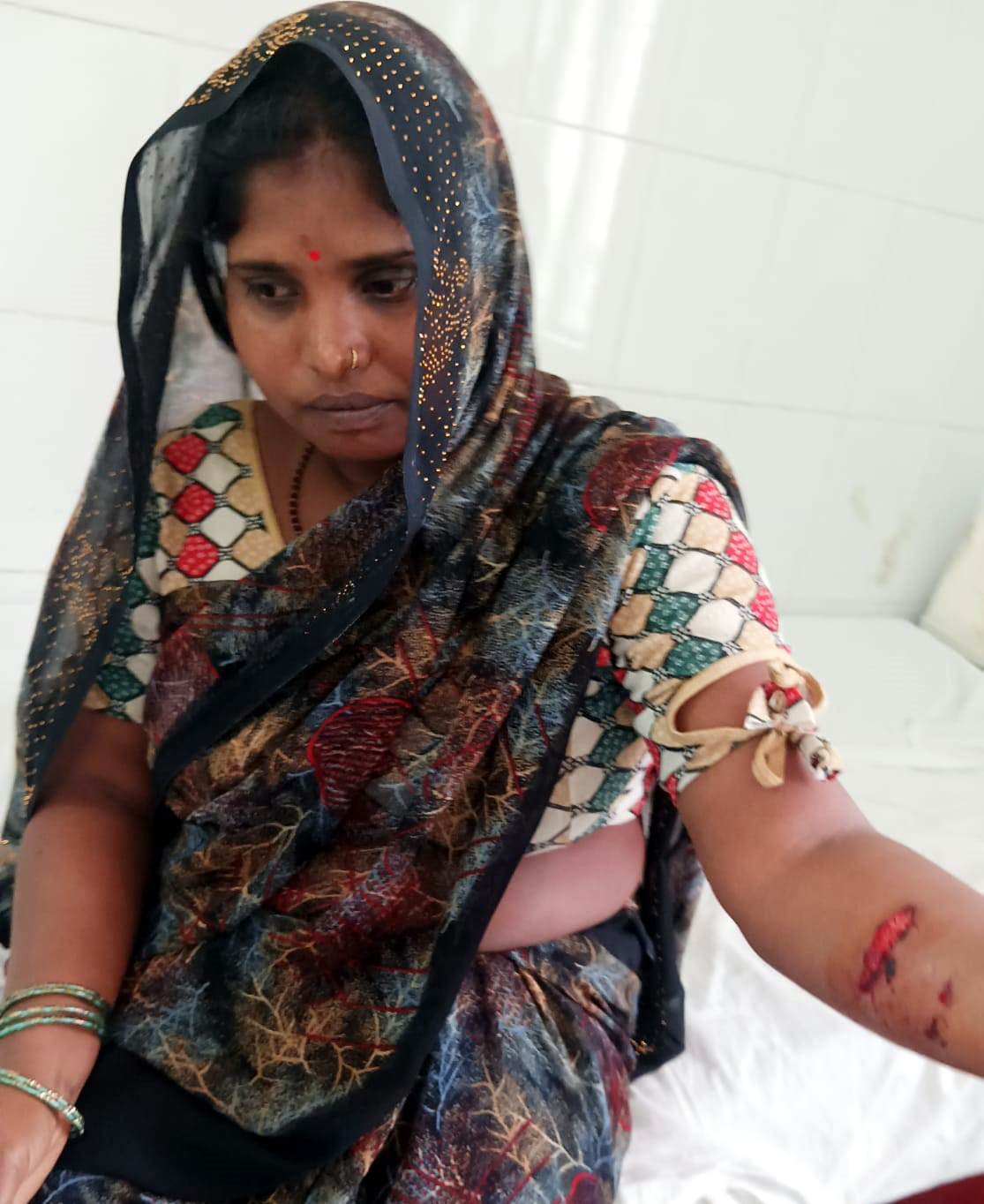 A dog was pulling the hand of a woman sleeping on a cot, she barely survived.