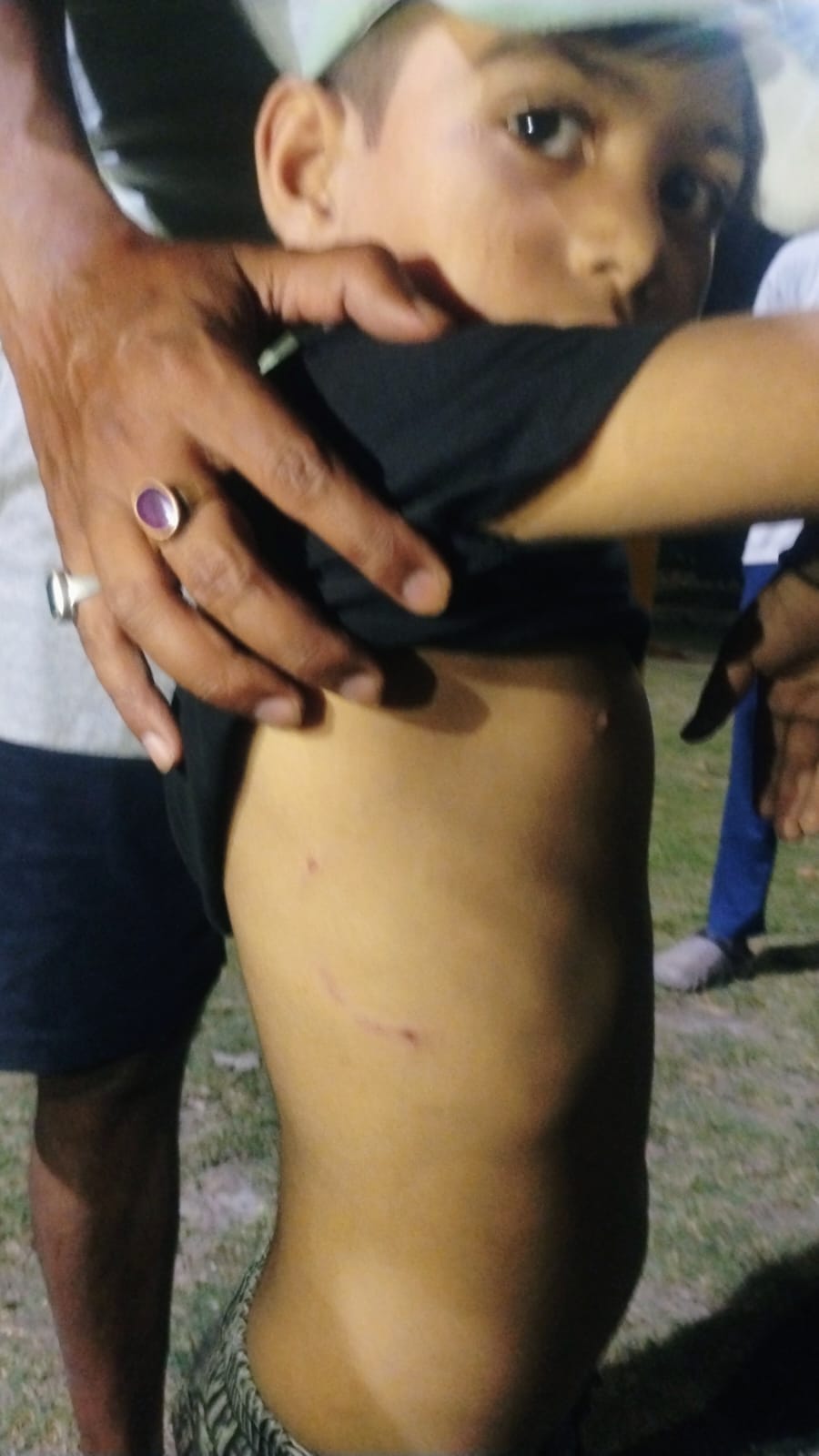 Theater artist's son bitten by a dog in the park.