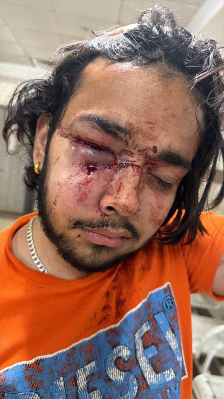 प्योंत टोल प्लाजा पर कर्मचारियों के हमले में घायल हुआ बीटेक का छात्र रोकी।