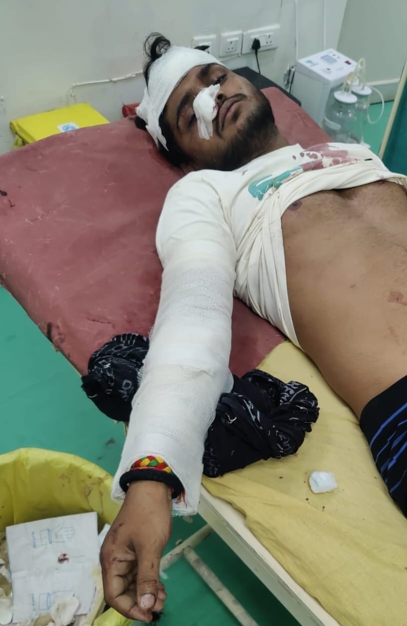 A young man who came to college with his brother was attacked with an axe, his condition is critical.
