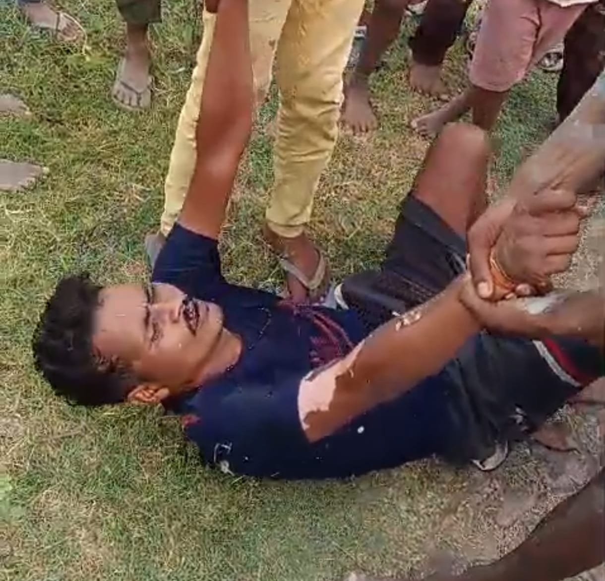 A young man was electrocuted while working on a high-tension line