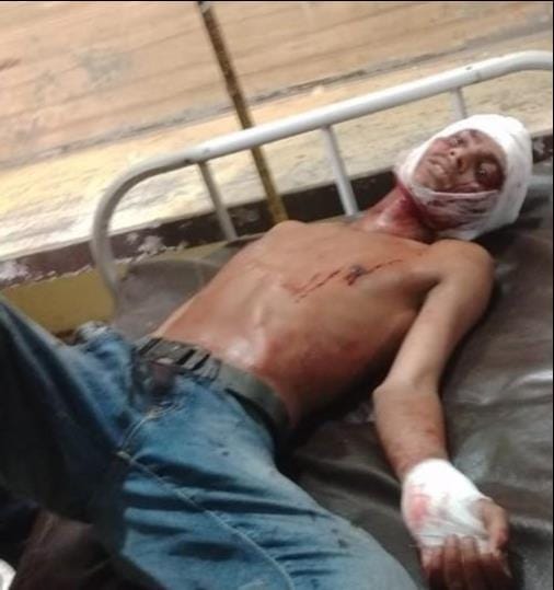A youth was attacked with a knife at a bhandara, and an FIR was lodged against four for attempt to murder.