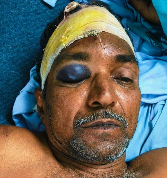 A man sleeping on a cot was attacked at midnight; the miscreants escaped by throwing stones.