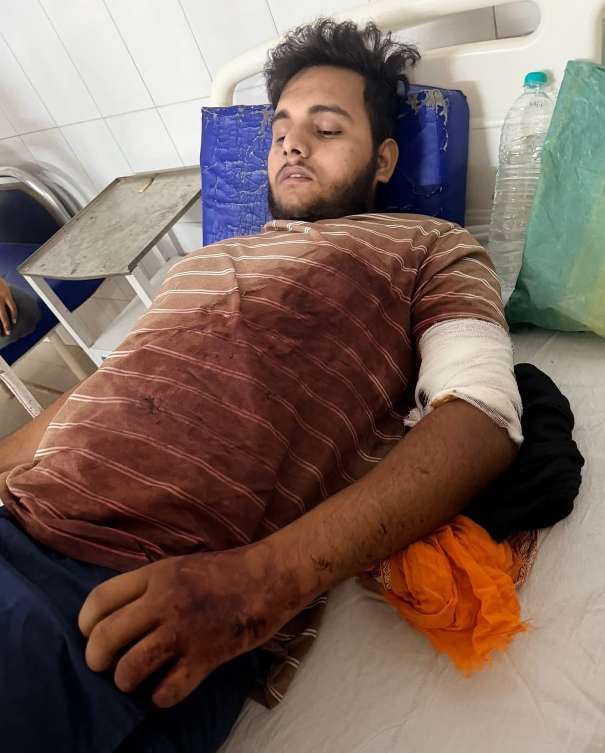 Youth attacked with sharp-edged weapon, FIR lodged against four