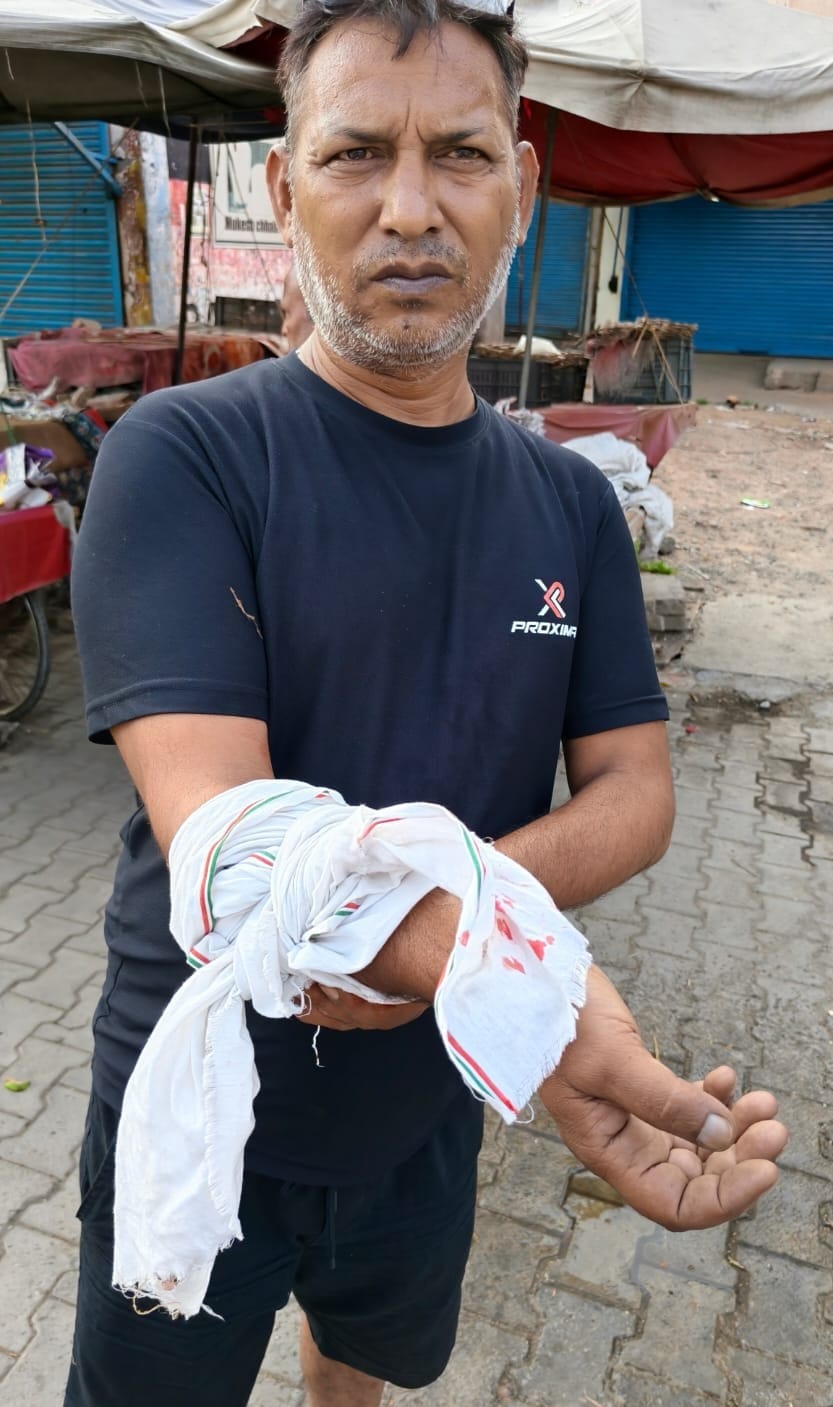 Monkeys attack shopkeeper, seriously injured