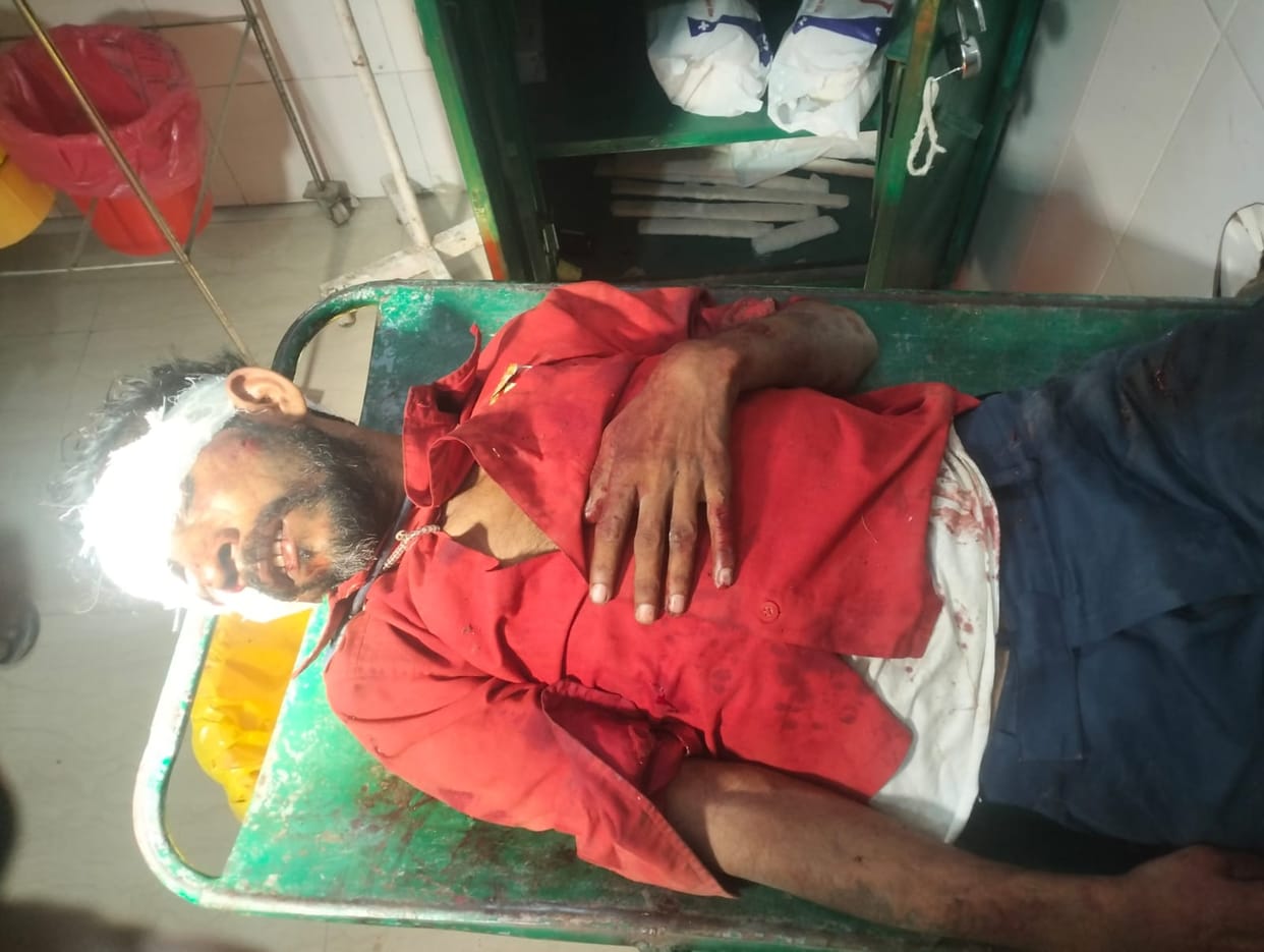 Two bike riders injured after being hit by a truck