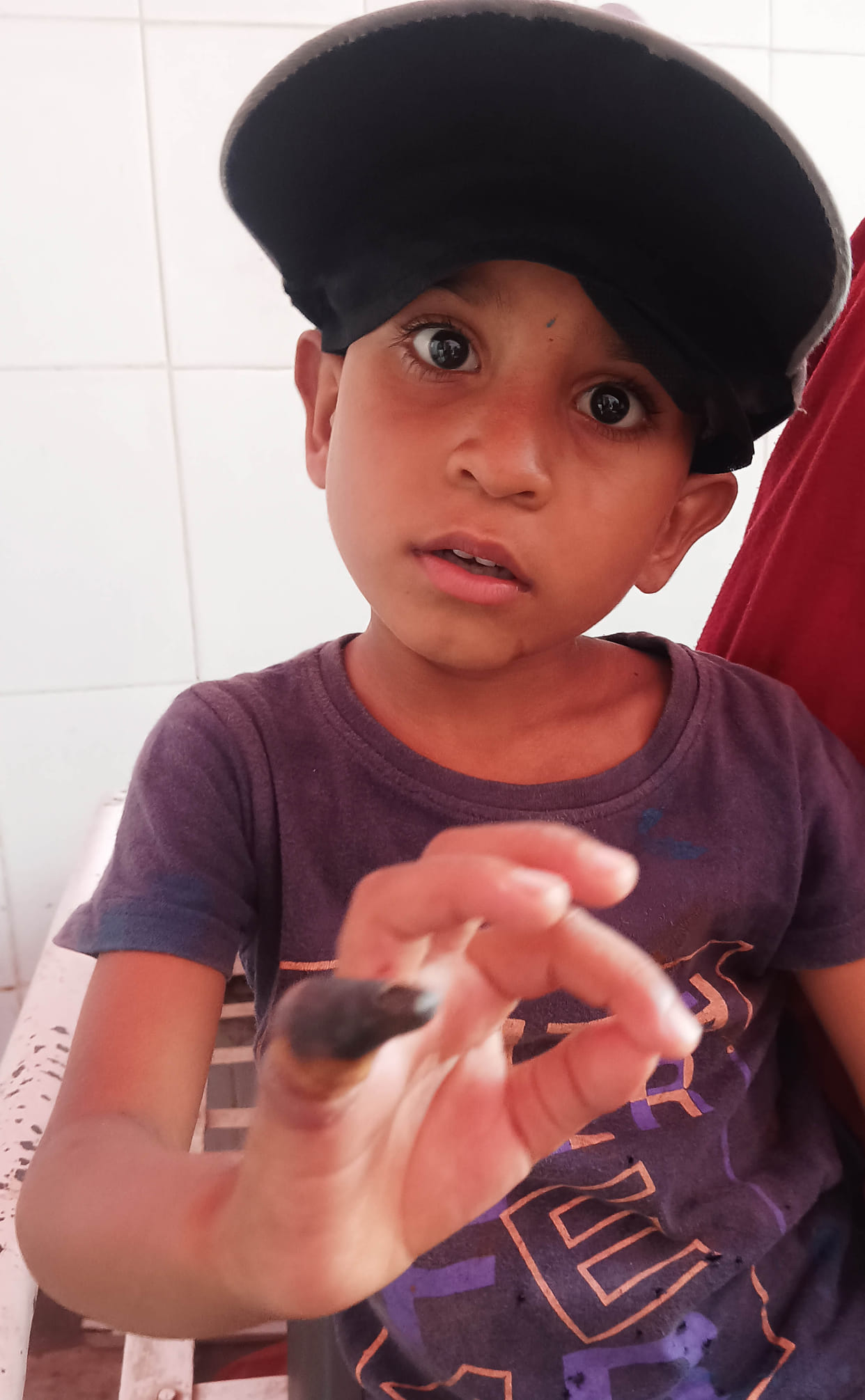 AGRA NEWS SCORPIAN BITE