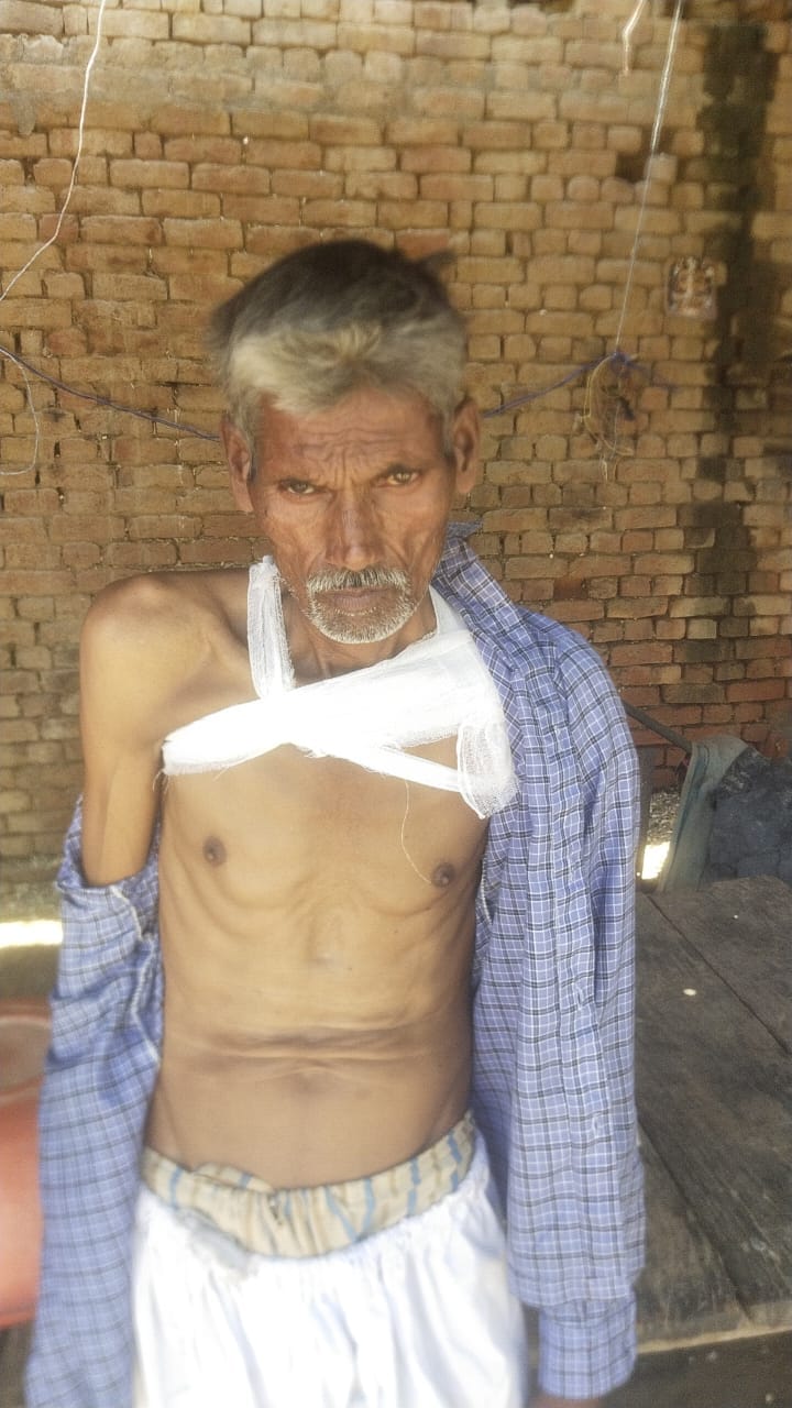 Pet bull knocks down and injures farmer.