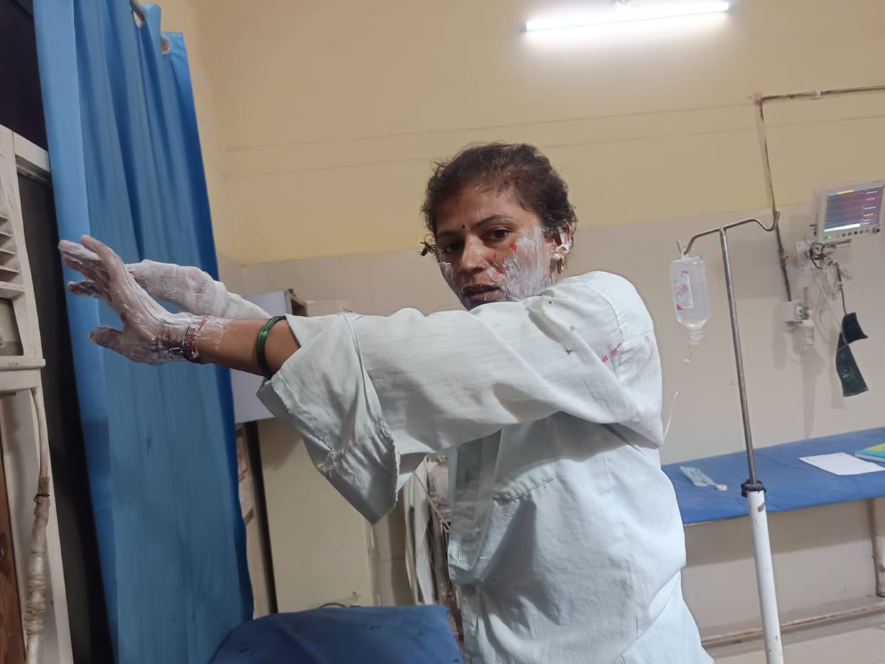 A woman making bangles was seriously burnt when a fire broke out while she was pouring oil into a container.