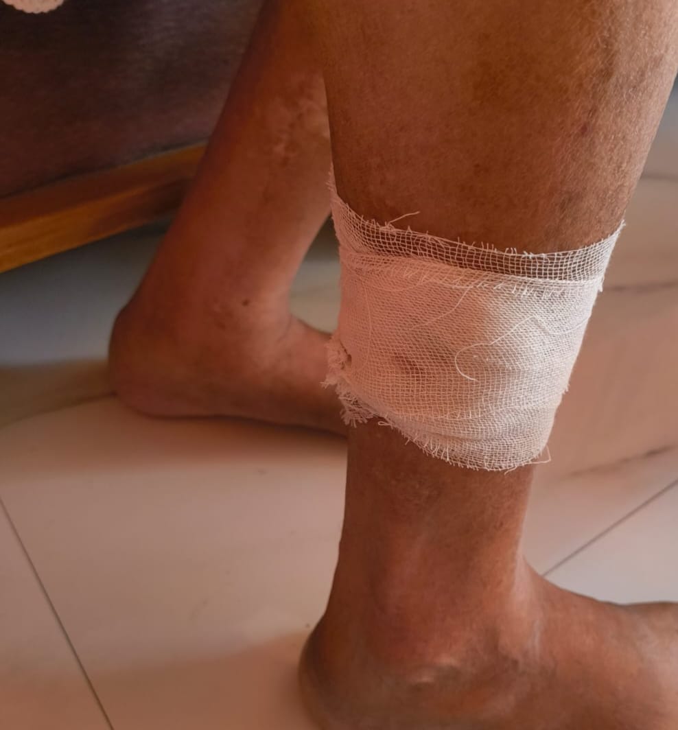 Former mayor attacked by pack of stray dogs, injured