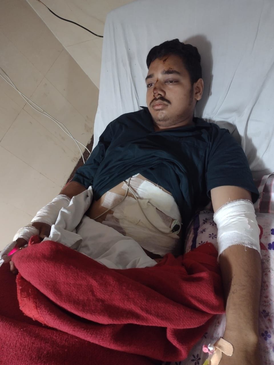ITI trainee gets electrocuted while fixing fuse, suffers burn injuries
