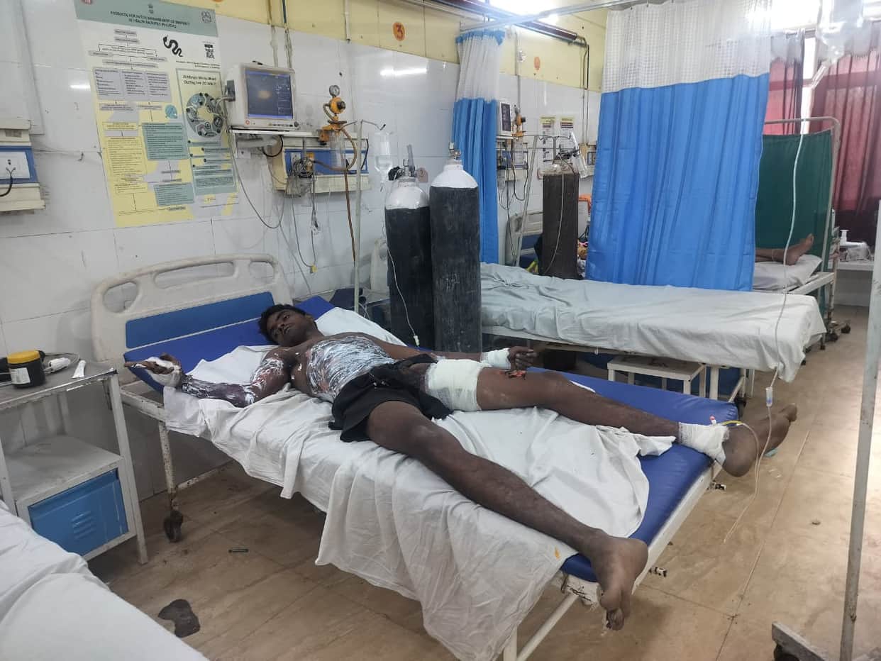 Rape accused flees court hearing, suffers burns after touching electric wire
