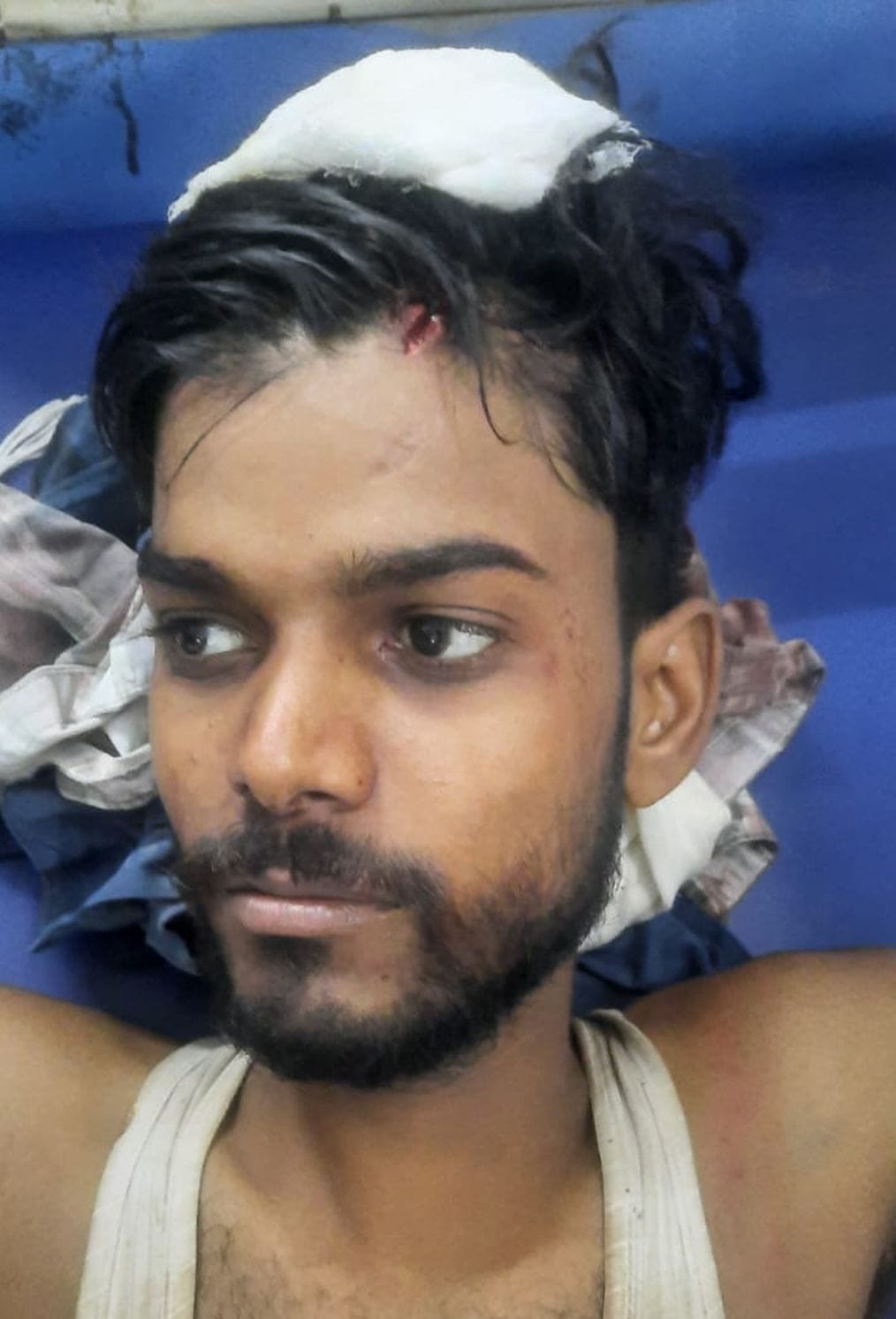Due to enmity, family was beaten up after entering the house, four seriously injured
