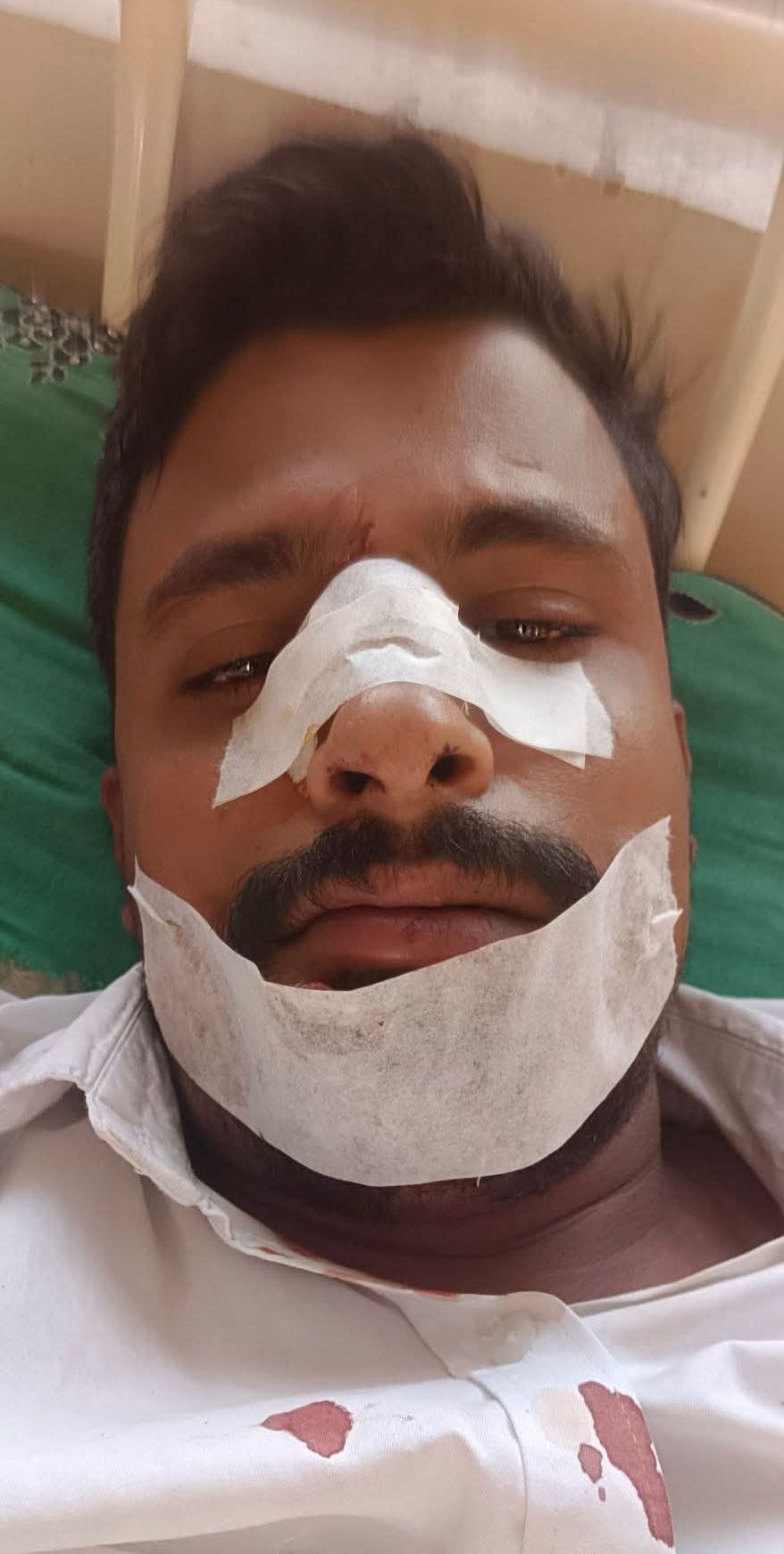 Congress leader's car overturns after going out of control; two injured.