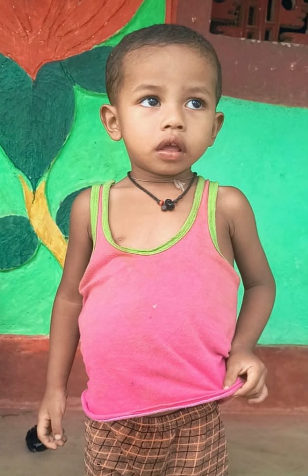 Anal and urinary passages were blocked from birth two successful surgeries transformed Arulesh life in Bastar