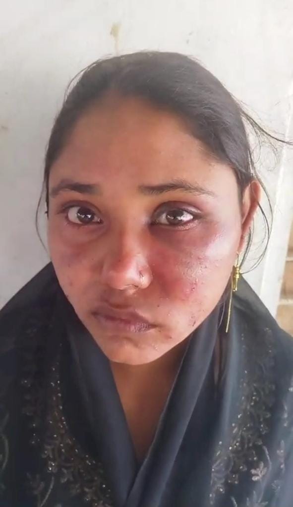 Attempt to burn wife alive by dousing her with diesel