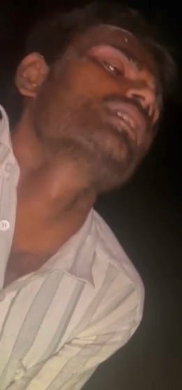 Twin brothers caught in police encounter; shot in the legs.