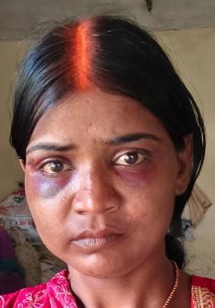 A married woman was beaten to death over dowry, she had gotten married just 54 days ago