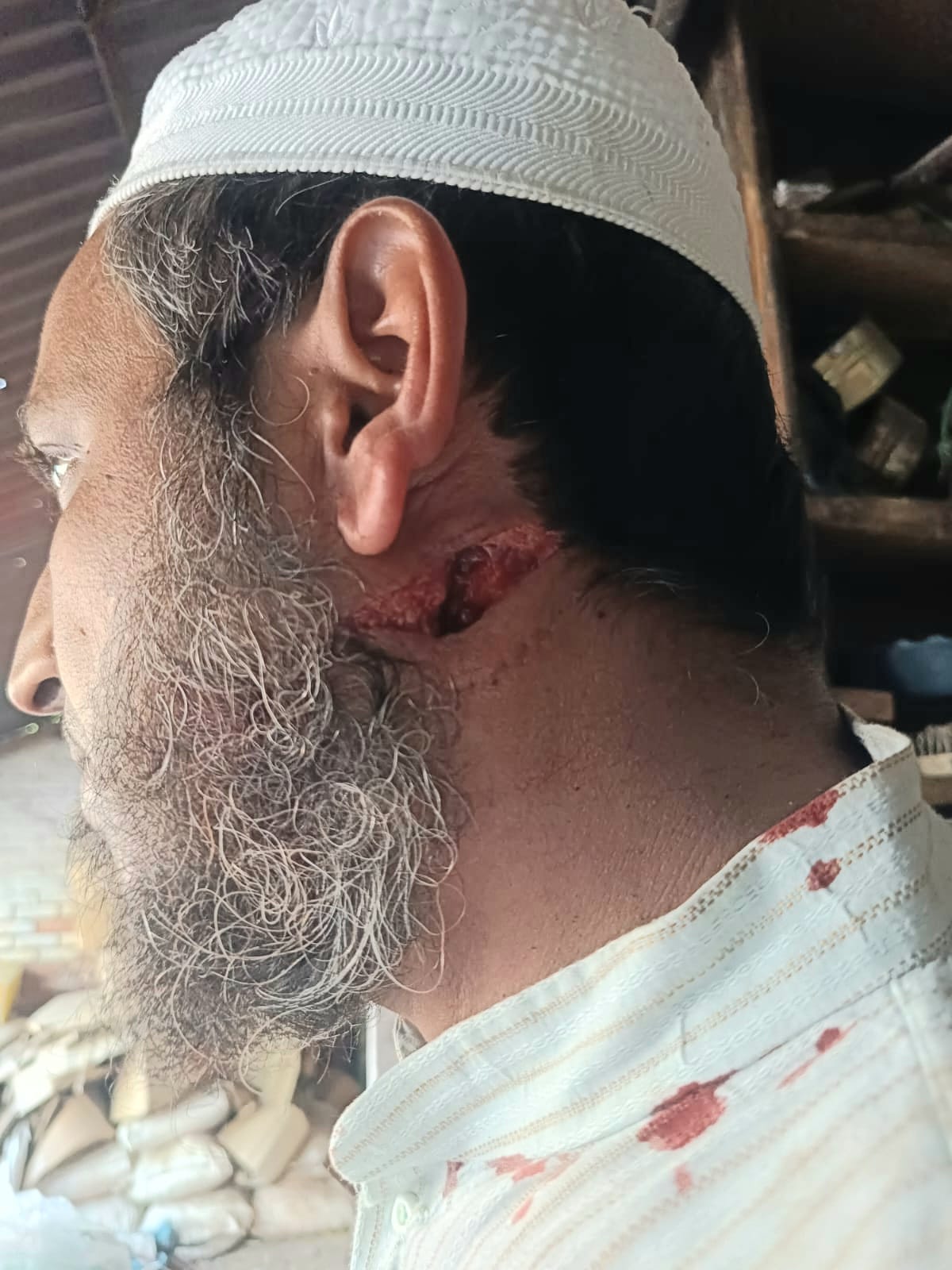 A langur attacked bike riders and bit three of them.