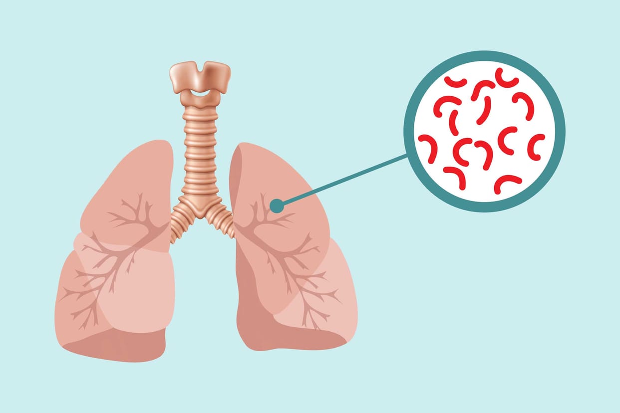 Detection of TB in children increased through the use of technology and better screening.