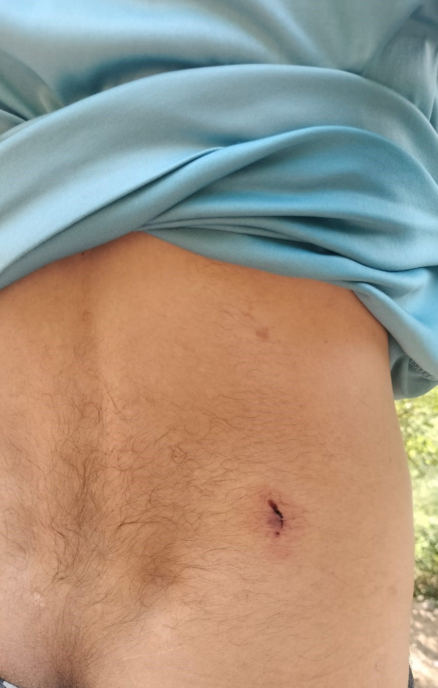 Shepherd injured in monkey attack near Saundal