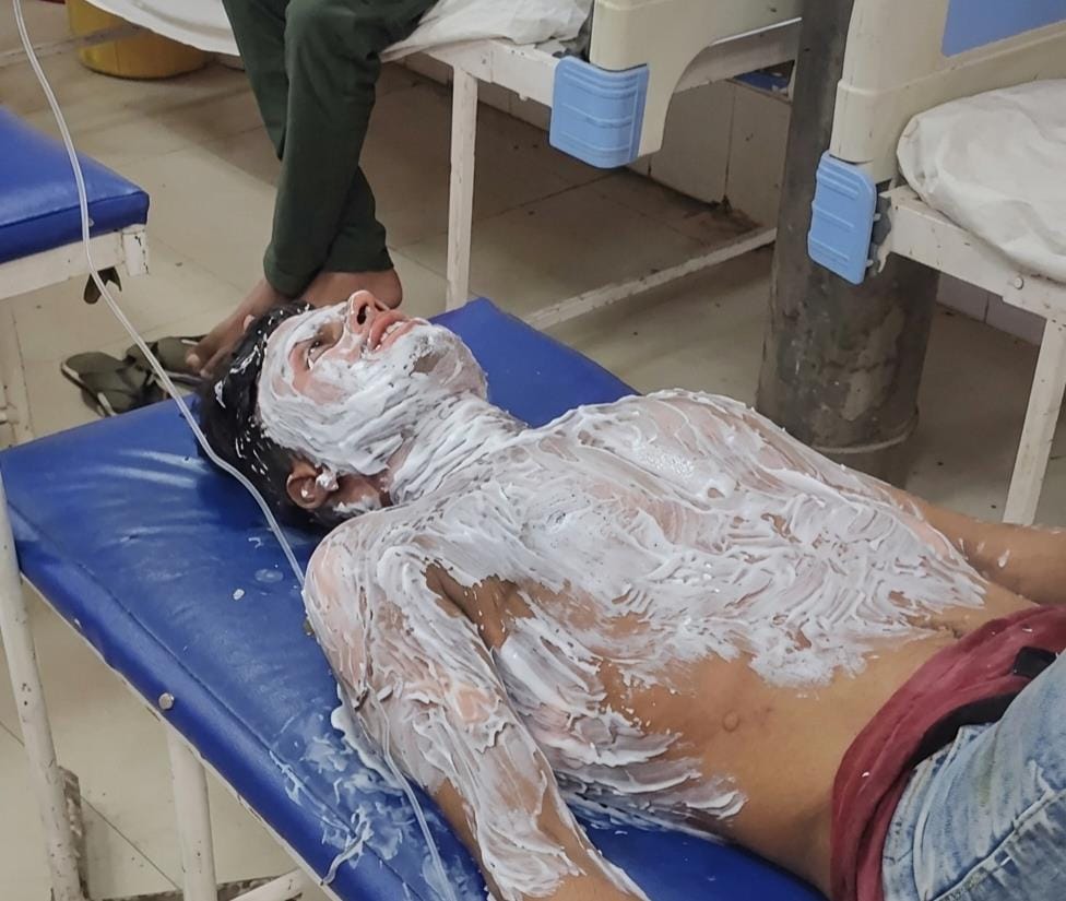 Son-in-law sets himself on fire after wife is not sent with him.