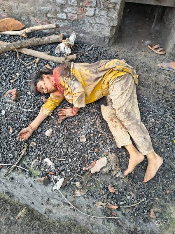 कटरा कोतवाली क्षेत्र के नटवा के पास लहुलूहान हालत में मिली महिला। स्रोत- सोशल मीडिया