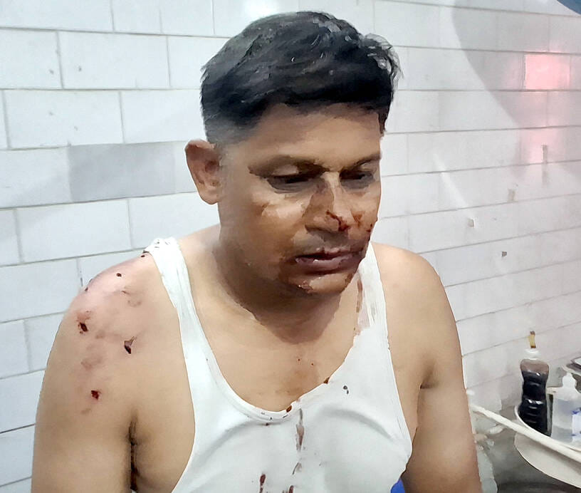 Forest worker injured while trying to catch leopard by laying a trap
