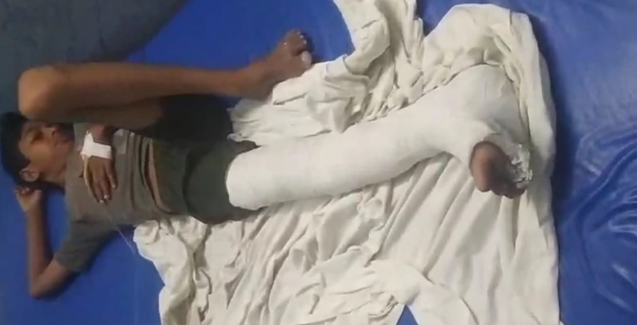 Innocent children playing on a haystack were beaten with sticks, one child's leg was broken.