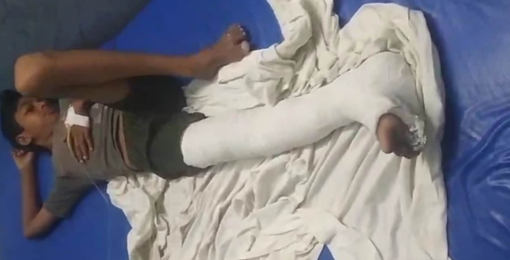 फोटो 4 मासूमों की बेरहमी से पिटाईघायल मोहित धौलपुर अस्पताल में उपचार के दौरान बालक जय दीप की