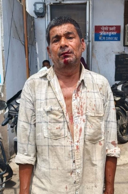 Vegetable vendor attacked for resisting extortion, sustained injuries to mouth and head