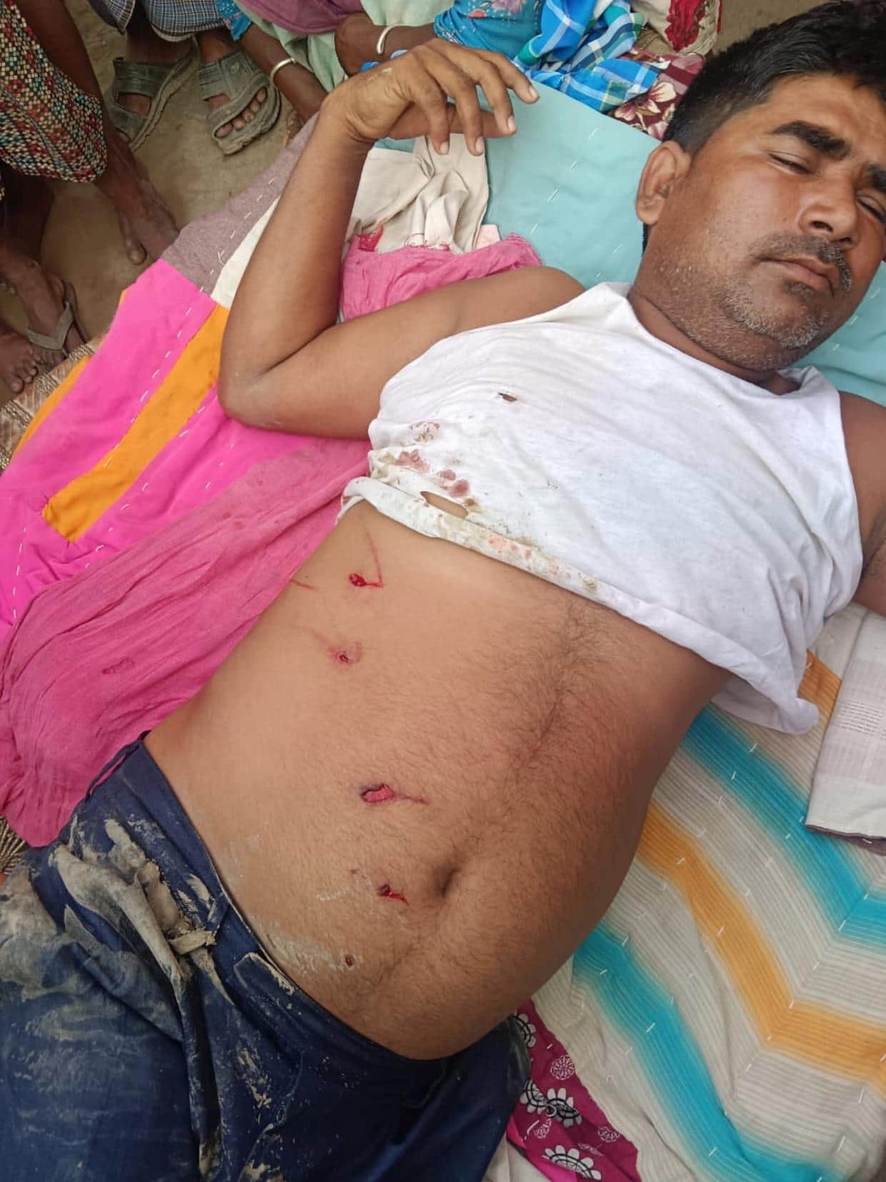 तेंदुए के हमले में घायल अख्तर।