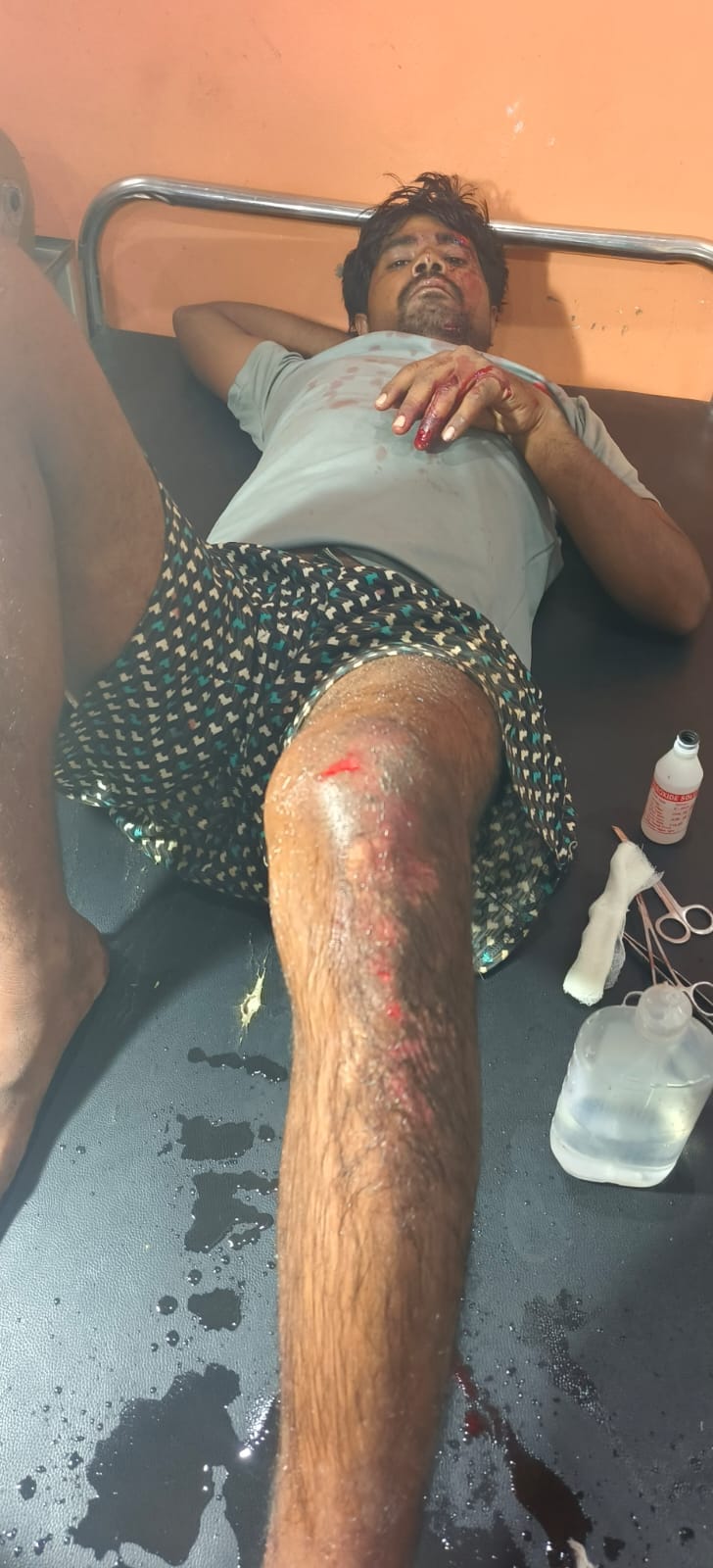 Three bike riders injured in collision with vehicle; one in critical condition.