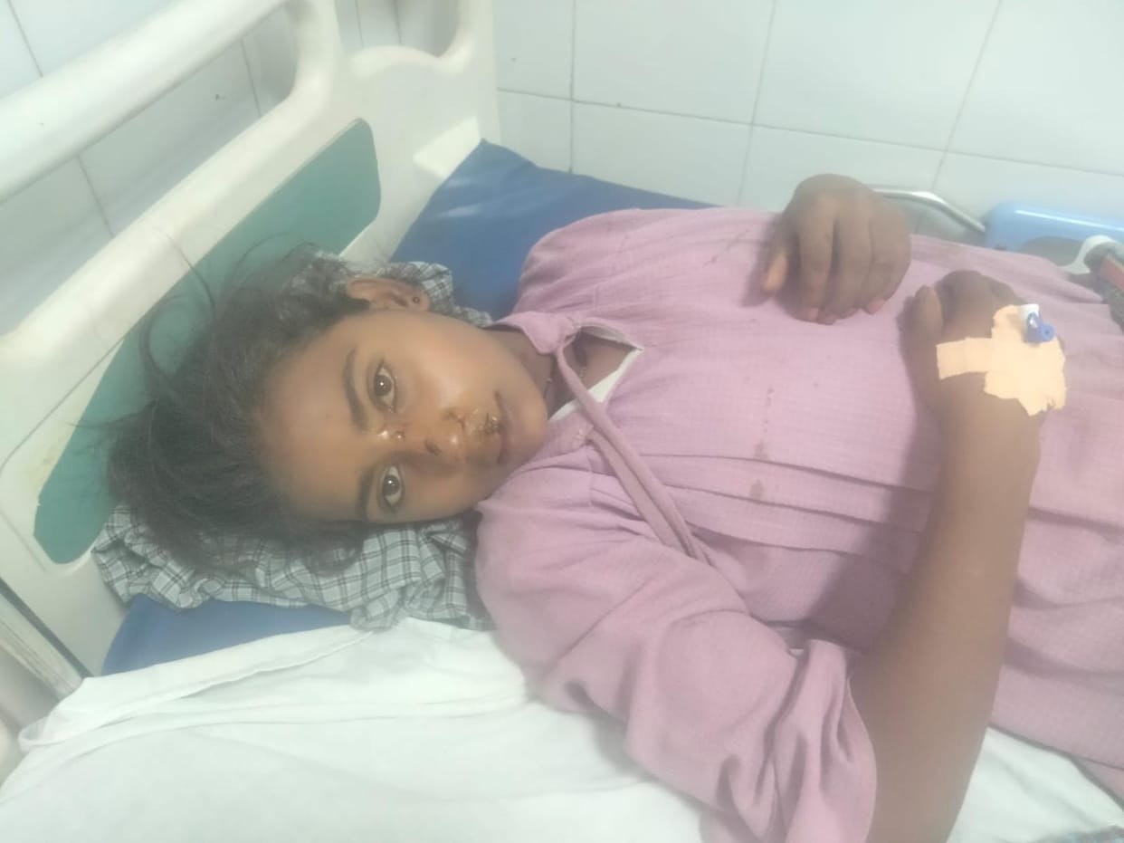 Teenager attacked by jackal while cutting grass; condition critical.