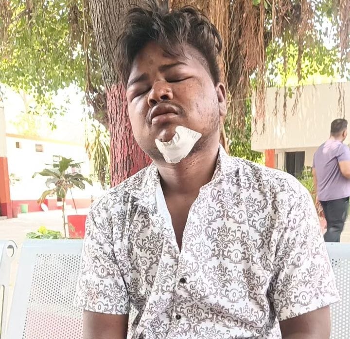 Drug addicts beat up retired serviceman's son, looted cash and watch