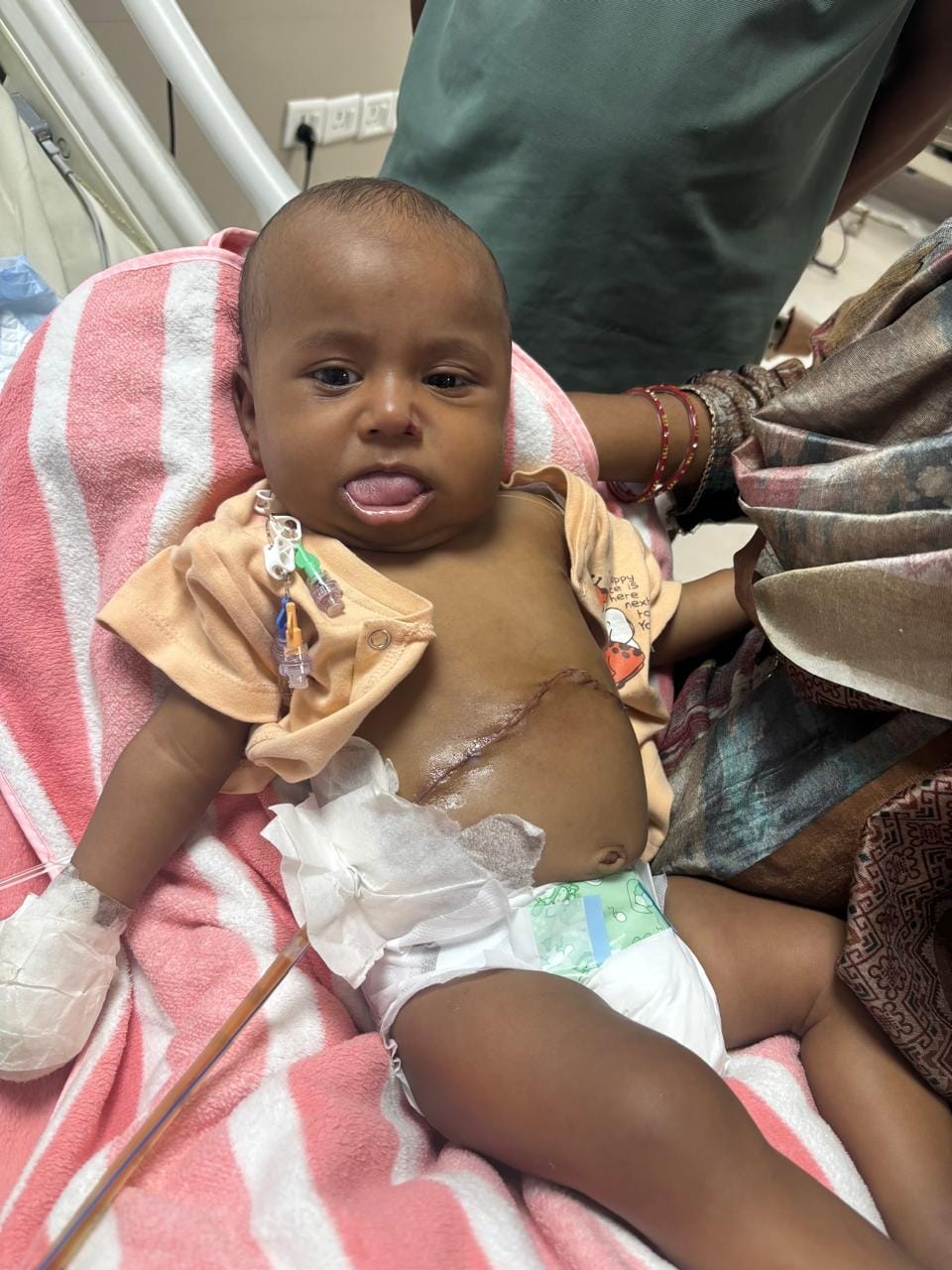 SGPGI gave a new lease of life to two children