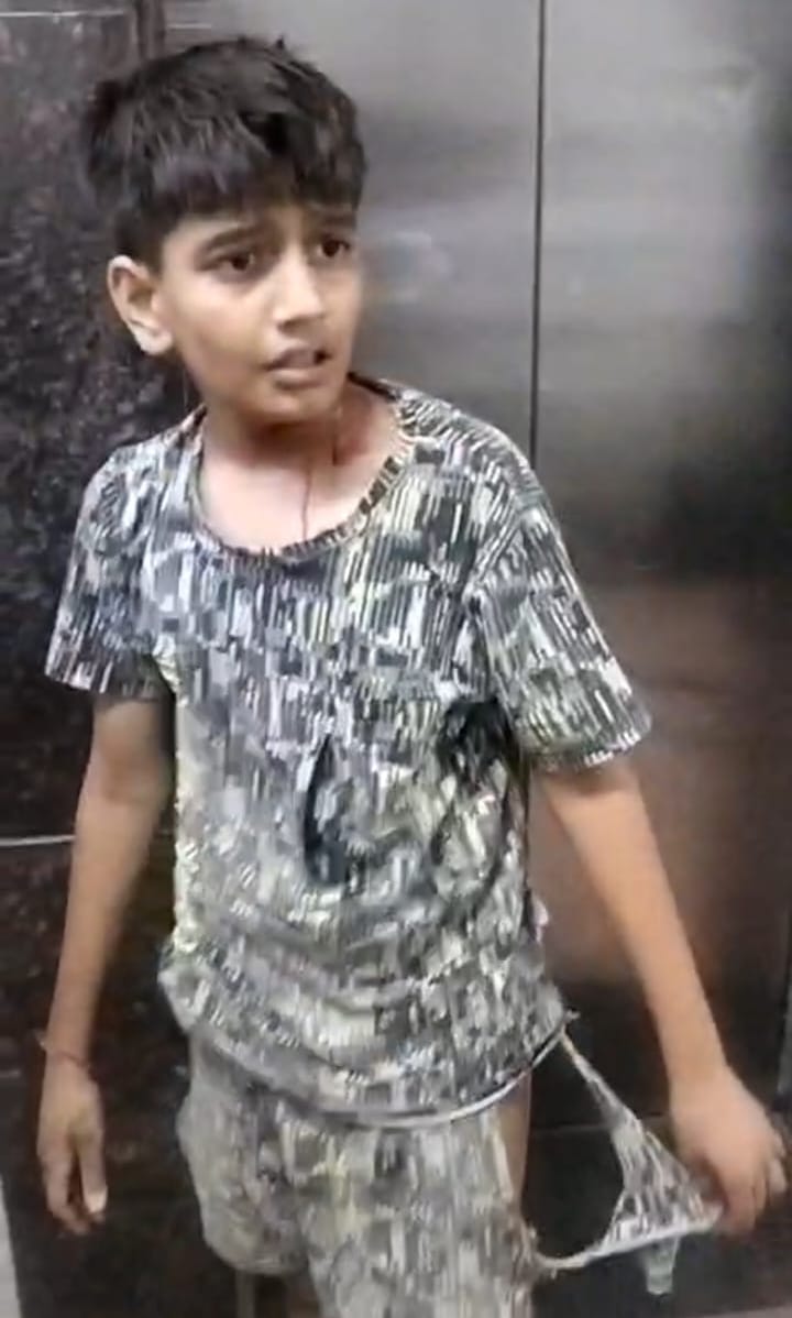 Dogs attack 10-year-old boy; he undergoes head surgery.