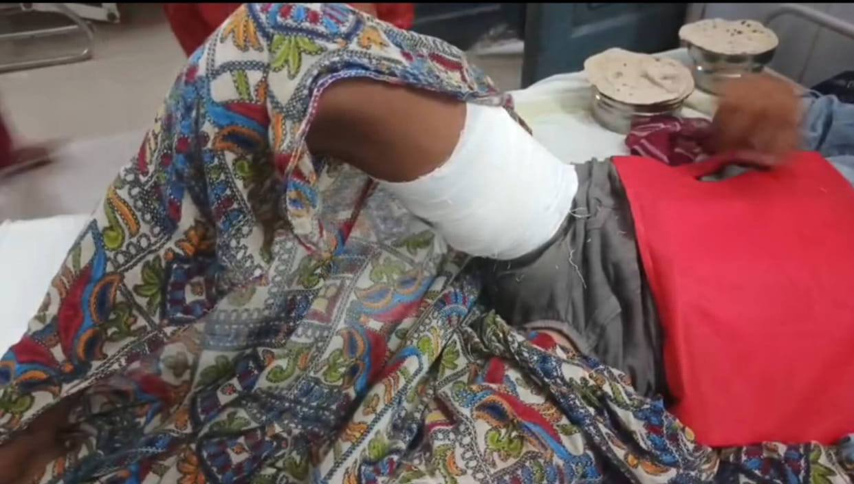 Rabid Monkey Attacks 14-Year-Old Boy in Panna, Tears Flesh from Thigh; 3 Victims in 48 Hours.
