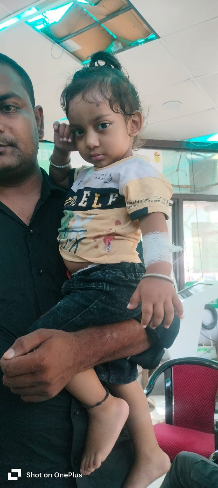 Female tourist bitten by monkey