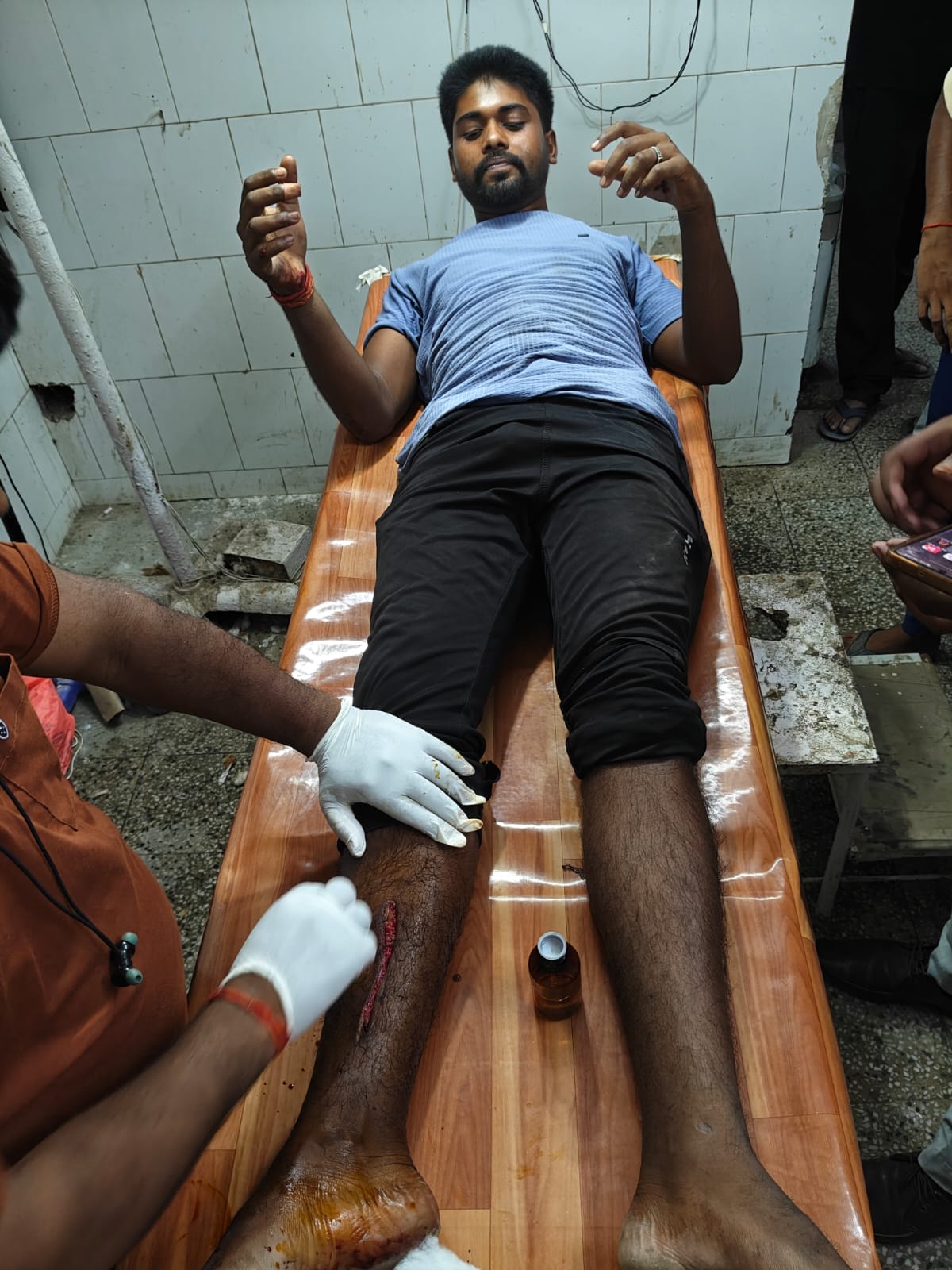 Youth injured in leopard attack in Maharajganj; leopard attacked twice at the same spot.