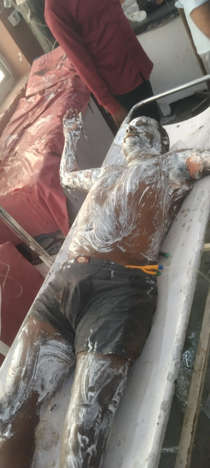 मेडिकल कॉलेज में भर्ती टोल कर्मी हीरामणि। संवाद