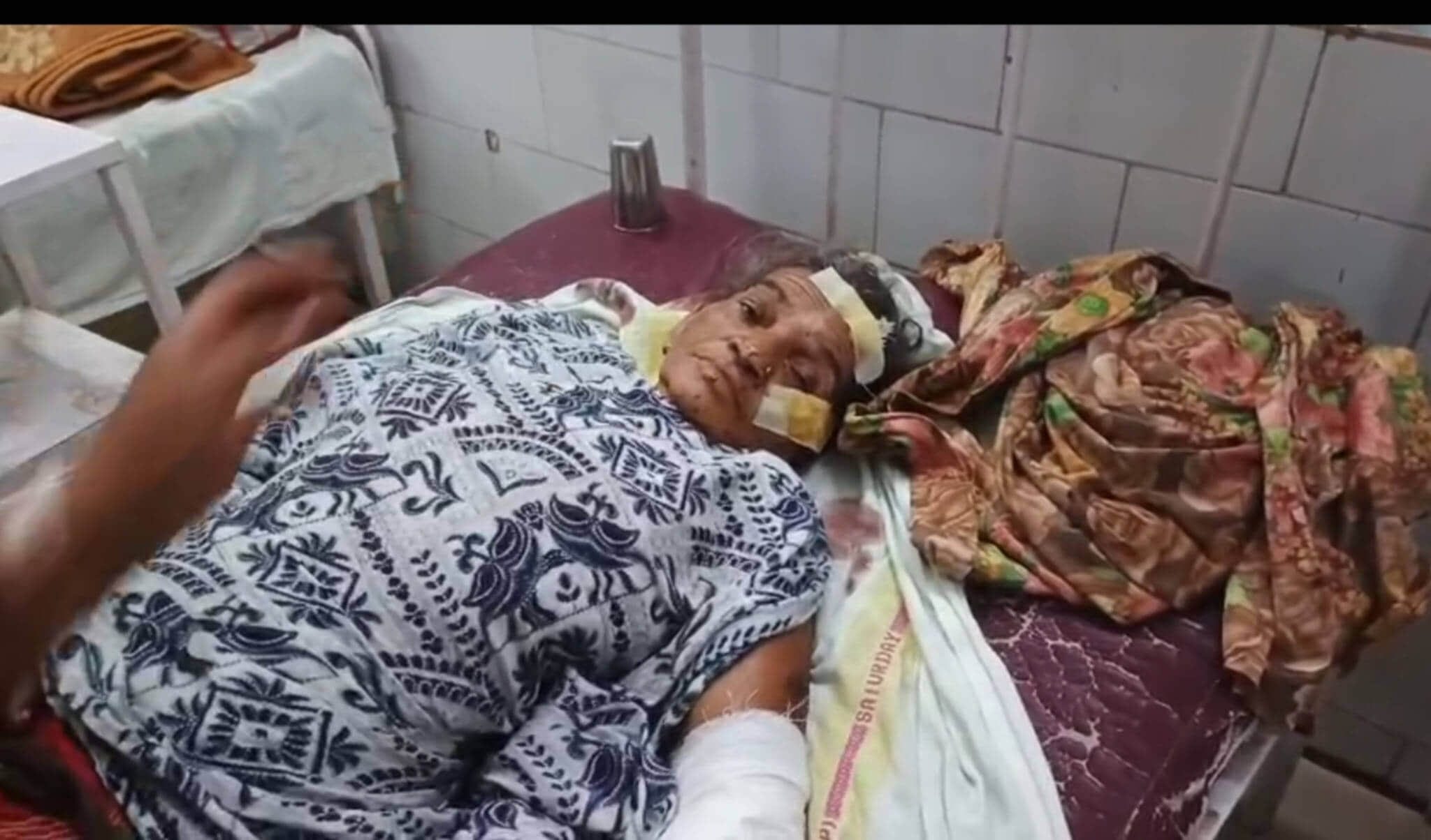 घायल  हल्की बाई