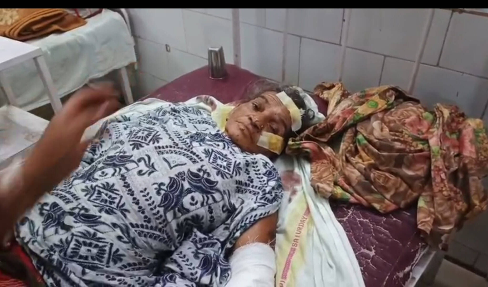 घायल  हल्की बाई