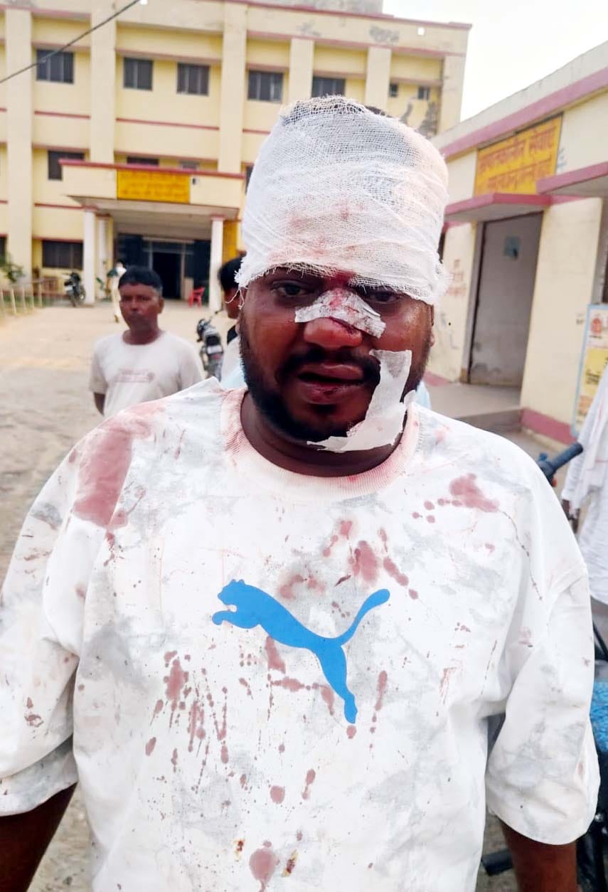 Youth dies, companion injured in collision between two bikes.