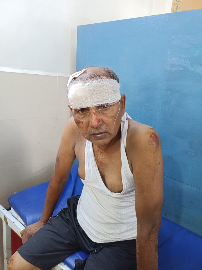 Car hits biological brothers; critically injured.